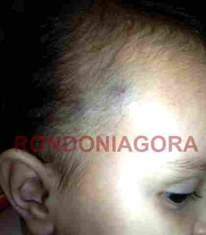 MÃE DE BEBÊ QUE TERIA SIDO ESPANCADO PELA BABÁ DENUNCIA DESCASO POLICIAL