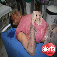 FOTOS MOSTRAM SEQUESTRADOR DE ARIQUEMES EM ESTADO CRÍTICO; IMAGENS FORTES