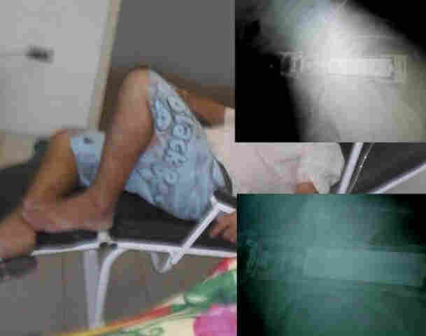 Caminhoneiro com lanterna no ânus será operado em hospital de Vilhena