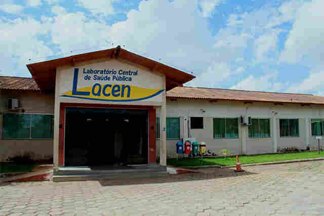 Com a chegada das chuvas, Agevisa alerta para cuidados com o vírus Influenza