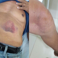 Idoso de 82 anos é espancado e suspeito acaba preso