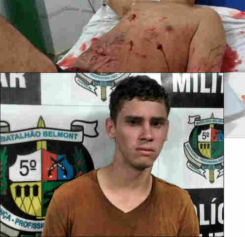 Jovem investiga traição, viaja de Mirante da Serra e ataca amante da esposa com 10 facadas na Capital