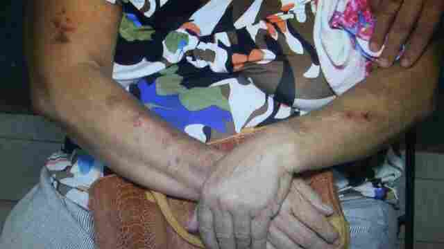 Violento, homem invade casa e agride ex-mulher e ex-sogra de 75 anos na capital