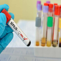 Porto Velho registra 70 casos de bebês infectados por sífilis congênita neste ano, informa Semusa