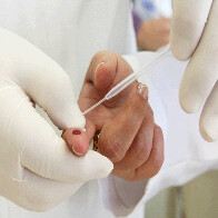 Ji-Paraná registra quase 50 novos casos de Aids neste ano