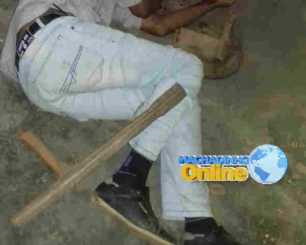 Homem quase é morto com golpes de cadeira em bar de Rondônia