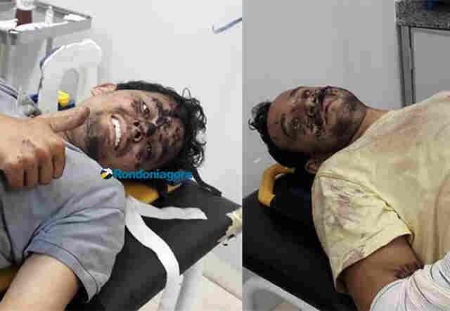 Pilotos que caíram com avião em Mato Grosso passam por cirurgia; 27 militares participaram de resgate