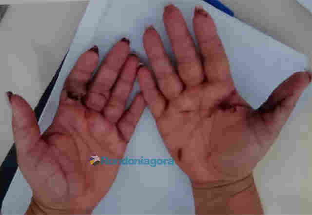 Decretada preventiva do homem que tentou matar mulher por ter sido rejeitado em Porto Velho