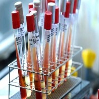 Casos suspeitos de Coronavírus em Rondônia sobem para 114; 63 em Porto Velho