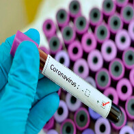 Enquanto Rondônia alega problemas para não divulgar dados, Acre anuncia 21 casos de Coronavírus