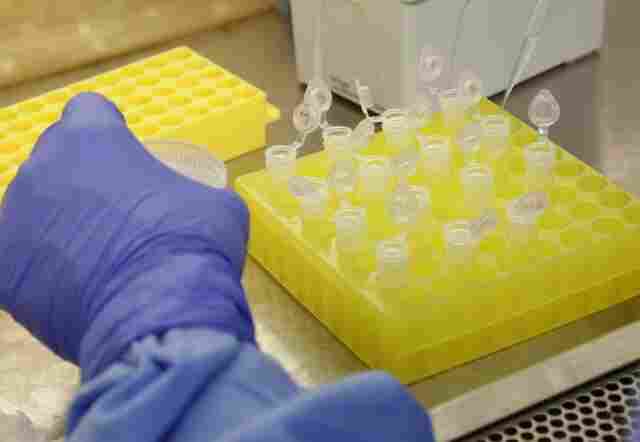 Rondônia chega a 4.743 casos de Coronavírus com 151 mortes; curados somam 2.143