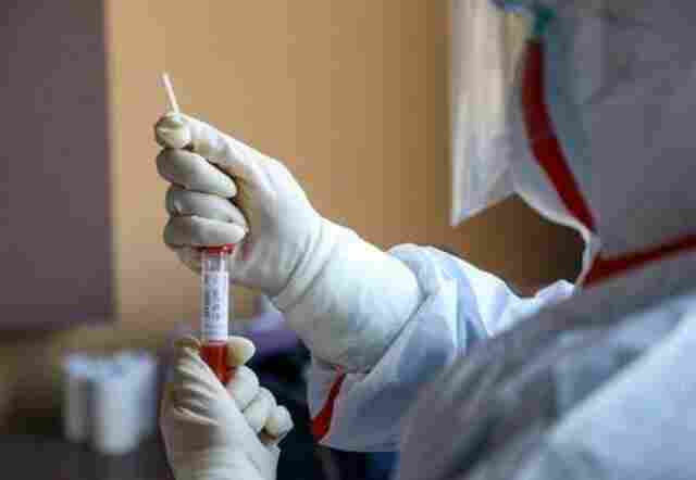 Coronavírus: 15 mortes e 716 casos registrados neste sábado em Rondônia