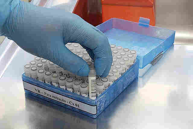 Rondônia chega a 26 mil casos de Coronavírus; mortes somam 606, 17 nas últimas 24 horas