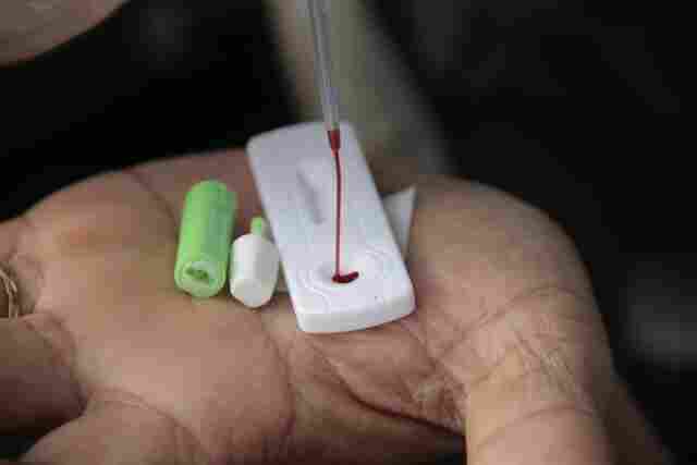 Rondônia registra 1.223 casos de Coronavírus e 15 mortes nesta terça-feira