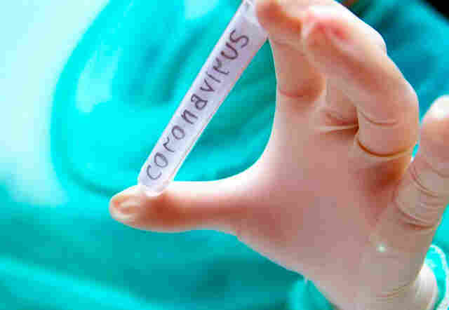 Quase 50 mil pessoas estão curadas do Coronavírus em Rondônia