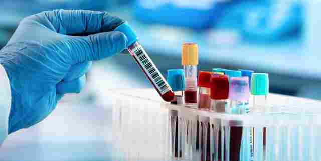 Sem registro de mortes por Coronavírus em Rondônia neste domingo