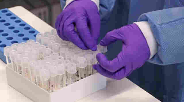 Rondônia registra 791 casos e 10 mortes por Coronavírus nesta terça-feira
