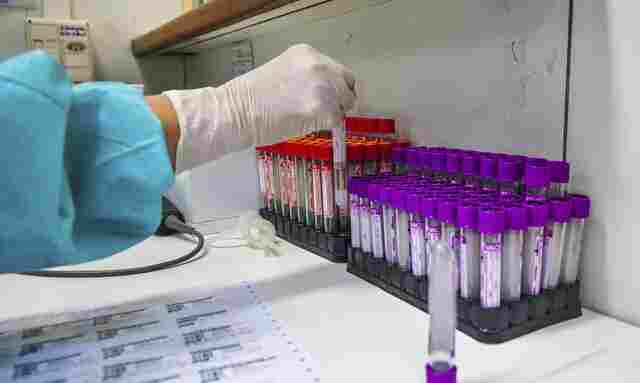 Mais 1.041 casos de Coronavírus e 14 mortes registradas nesta terça-feira em Rondônia