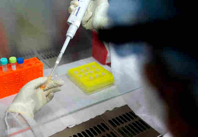 Rondônia registra 8 mortes por Coronarívus e 279 casos da doença neste domingo