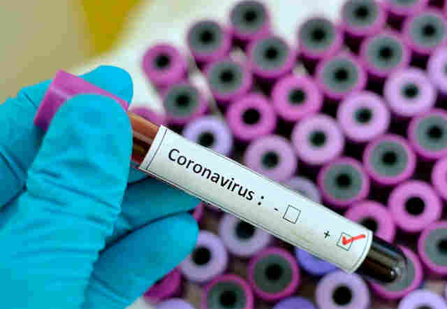 Rondônia registra 16  mortes por Coronavírus e 947 casos da doença nesta quinta-feira