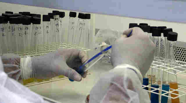 Rondônia registra uma morte por Coronavírus e 123 casos neste sábado