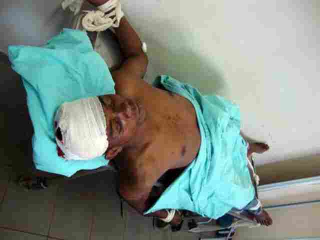 Deficiente auditivo sofre corte profundo de garrafa na cabeça após briga