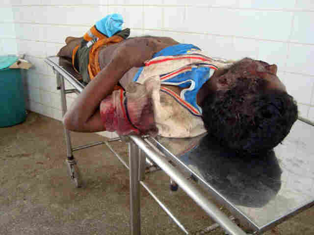 Homem não identificado morre atropelado na BR-364 e motorista foge