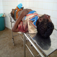 Homem não identificado morre atropelado na BR-364 e motorista foge