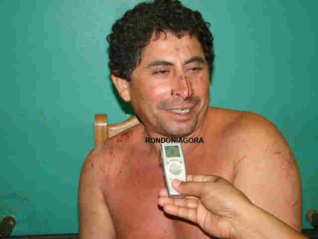 PM e PC na fronteira prendem homem que decepou mão e matou esposa com facão