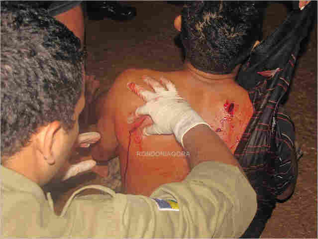 Não gostou de furas filas e acabou levando duas facadas - Imagem