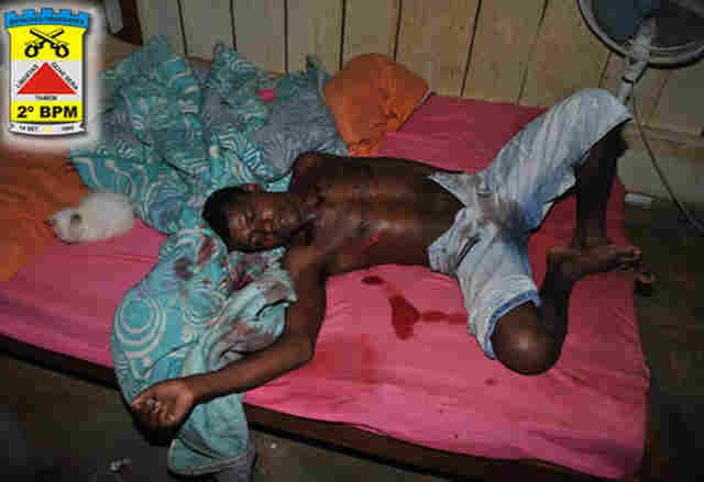 Bebedeira quase termina em tragédia: homem leva 13 facadas