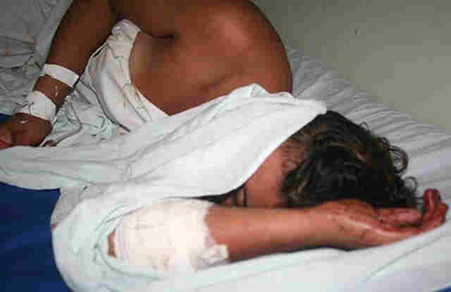 Grávida leva 7 facadas após ser estuprada em Jaru