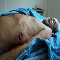 FOTOS MOSTRAM CORPO DE ADELINO RAMOS BALEADO  ATENÇÃO: Imagens podem chocar