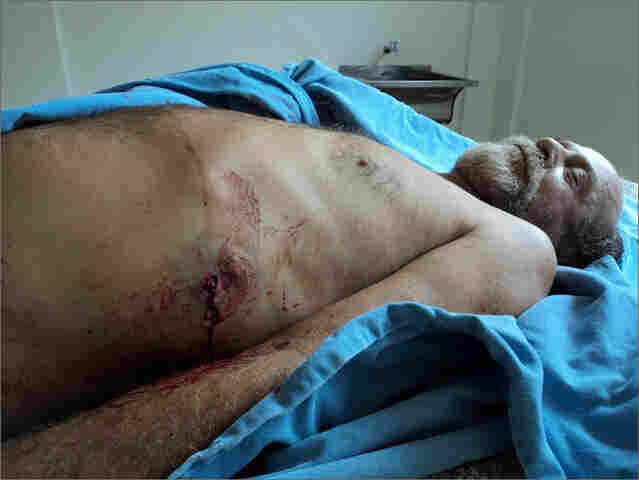 FOTOS MOSTRAM CORPO DE ADELINO RAMOS BALEADO  ATENÇÃO: Imagens podem chocar