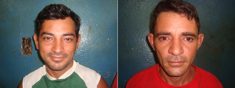 Queriam dinheiro: irmãos viciados agridem o próprio pai