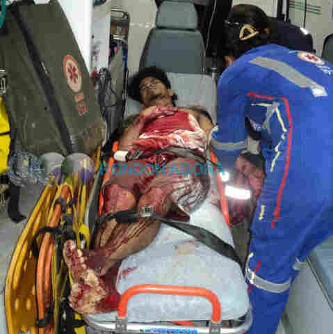 Mais um é atacado a golpes de facão na Capital; imagens fortes