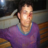 Assalto e troca de tiros em Cerejeiras