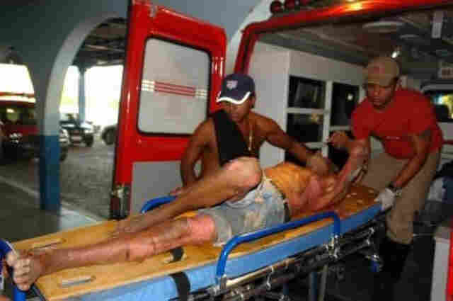 Ancião tem 80% do corpo queimado ao colocar fogo em mato