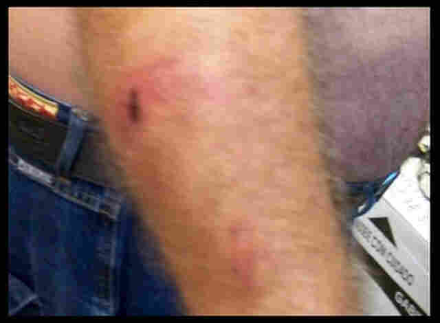 Policial rodoviário denuncia agressão de PMs em Ji-Paraná