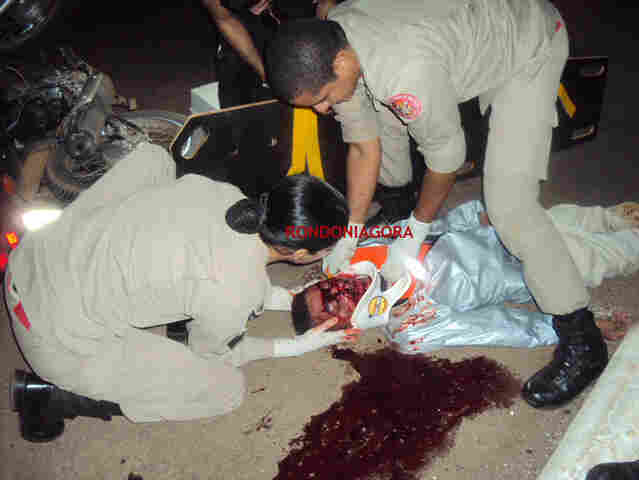 ACIDENTE NA MADRUGADA DEIXA MOTOCICLISTA EM ESTADO GRAVE; CONFIRA VÍDEO E FOTO - Imagem forte