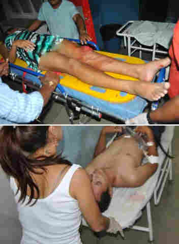 Homem não admite a separação e atira contra ex-esposa e o namorado; fotos