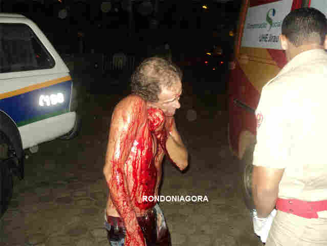 Esfaqueado na rua, homem corre para Delegacia