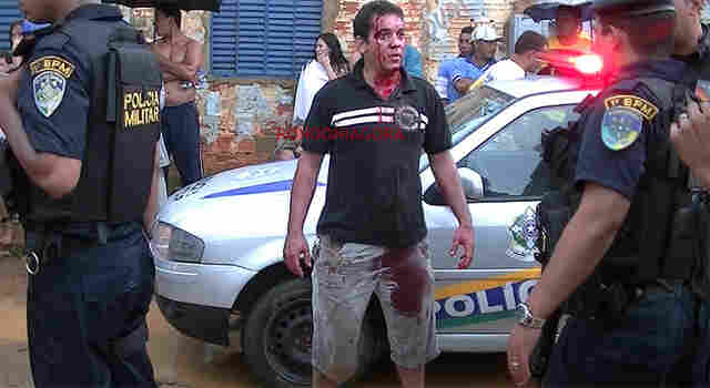 MULHER É BALEADA APÓS DUPLA TENTAR ASSALTAR PM; Fotos