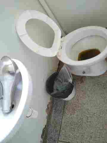 UTI do Hospital de Base sem pia e com banheiros condenáveis