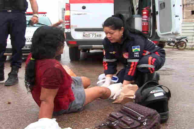 Motociclista e carona tem fraturas expostas em grave acidente; Fotos