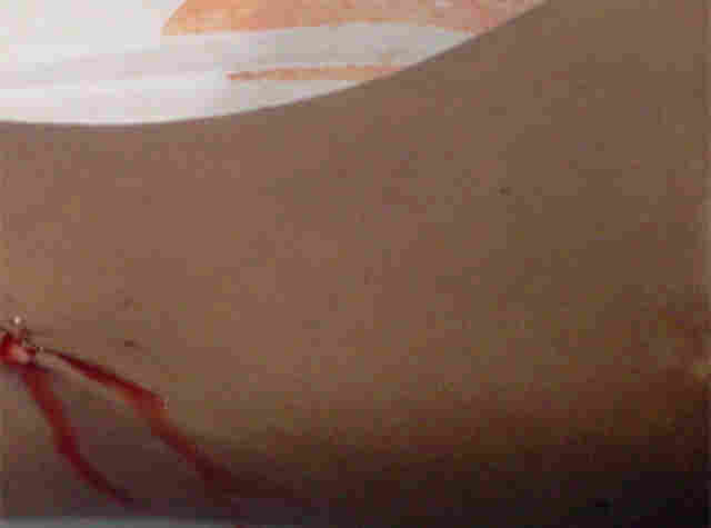 USUÁRIO DE DROGA MATA IRMÃO DEFICIENTE QUE TENTOU DEFENDER A MÃE