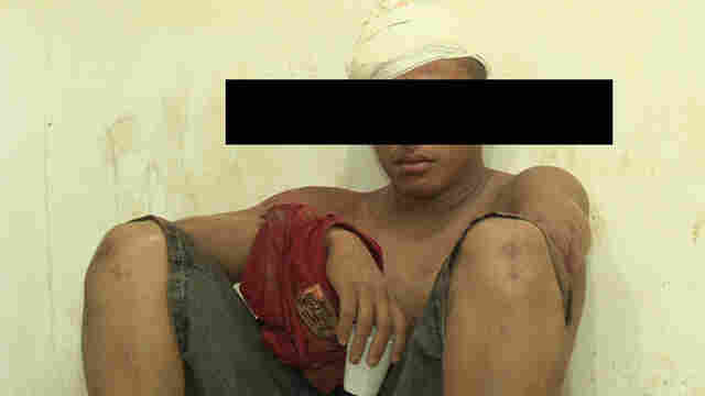 Em crise, jovem quebra porta de vidro na base da PM