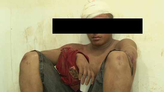 Em crise, jovem quebra porta de vidro na base da PM