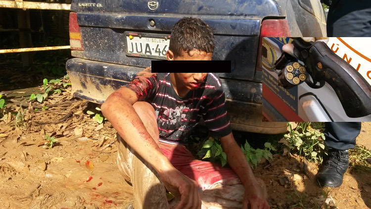 MENOR LEVA TIRO DE RASPÃO AO ASSALTAR POLICIAL