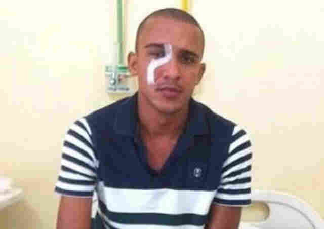 Policial que teve canivete cravado na cabeça tem mal súbito e morre